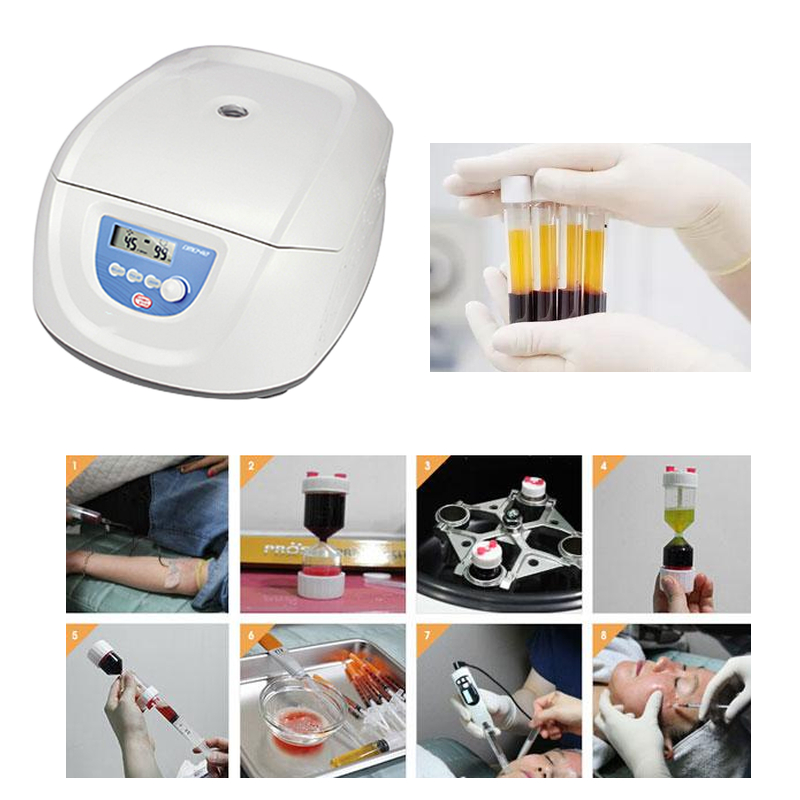 أفضل جهاز طبي لفصل البلازما ال - مراجعة Medical Lab Center وسعره